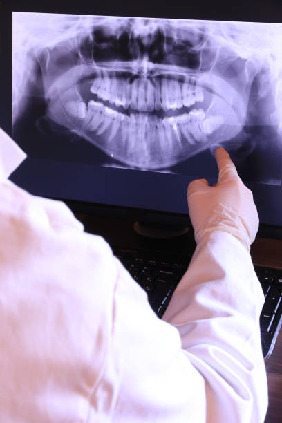 Best Emergency Tooth Extraction in Auburn Lake Trails, CA