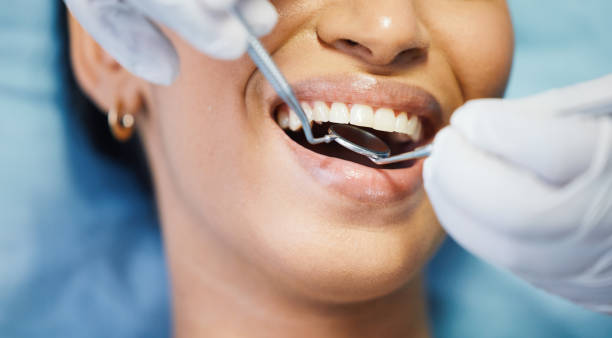 Best Emergency Wisdom Teeth Removal in Auburn Lake Trails, CA