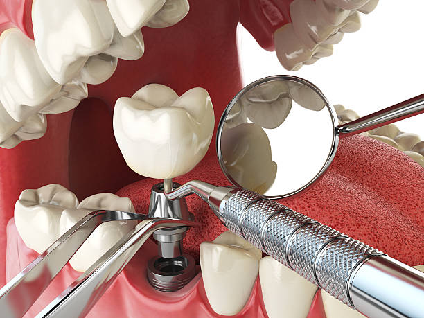 Best Emergency Dental Surgery in Auburn Lake Trails, CA